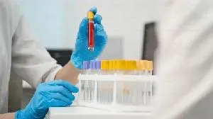 AusperBio to Present Long-Term Follow-Up Data of AHB-137 Treatment in Chronic Hepatitis B in Two Late-Breaking Oral Presentations at AASLD The Liver Meeting® 2026