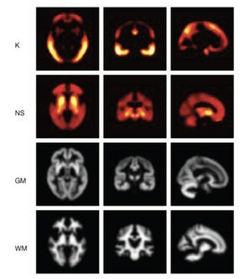 Calyx and Invicro agree to combine to create a global leader in medical imaging and software solutions for the clinical research community