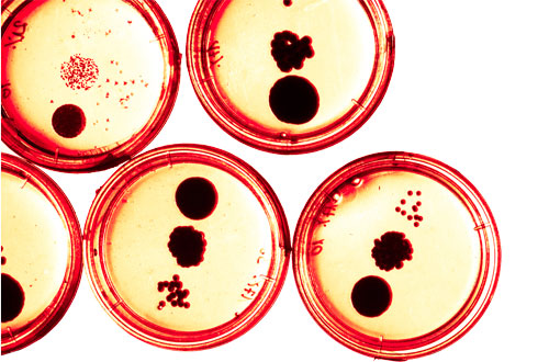 PACE announces partnership with UKHSA to tackle antimicrobial resistance