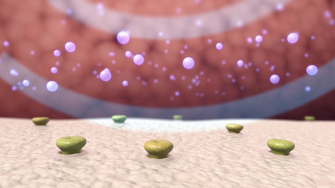 Surf Therapeutics Announces Early Feasibility Study (EFS) To Advance Non-Invasive Approach to Neuromodulation for Rheumatoid Arthritis