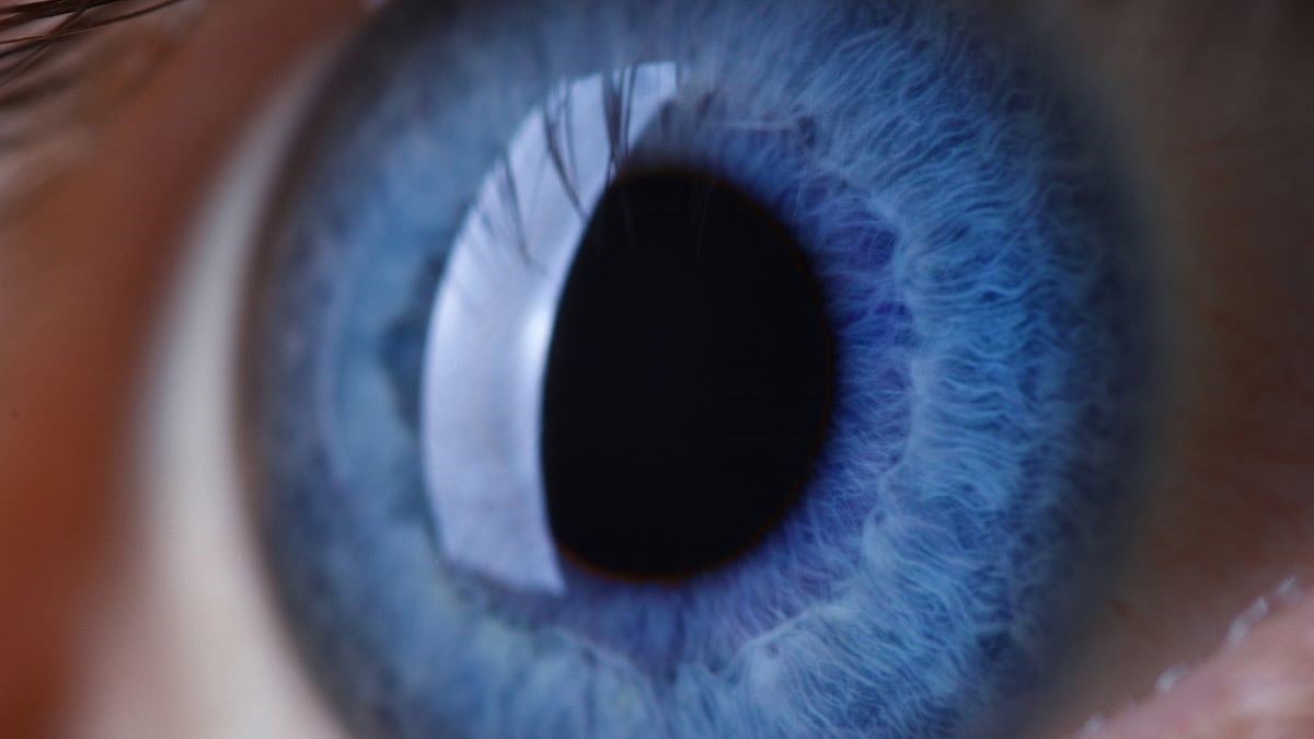 No Increase Seen in Neovascular AMD Risk After Cataract Surgery