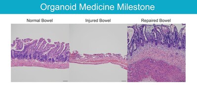 Organoid Medicine Milestone Reported in Cell Stem Cell