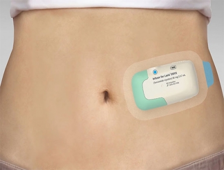 Gerresheimer Announces Tentative Approval of SQ Innovation Lasix ONYU from FDA