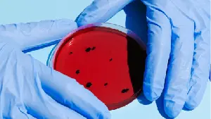 Aicuris Enrolled Last Participant in Pivotal Trial with Pritelivir to Treat Refractory Herpes Simplex Infection in Immunocompromised Patients