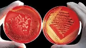 Basilea receives USD 39 million funding under BARDA agreement to continue to advance novel antifungals fosmanogepix and BAL2062