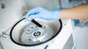 Biodexa Announces Filing of CTA in Europe for Phase 3 Serenta Trial in  Familial Adenomatous Polyposis (FAP)