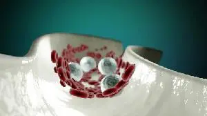 Celldex Presents Data Demonstrating Profound Long Term Improvement in Angioedema in Barzolvolimab Phase 2 Study in Chronic Spontaneous Urticaria at EAACI 2025