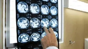 HUTCHMED Announces NDA Acceptance in China with Priority Review Status for Savolitinib for the treatment of Gastric Cancer Patients with MET Amplification