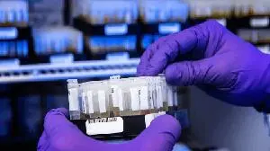 European regulators greenlight first clinical test of GLP-1 gene therapy