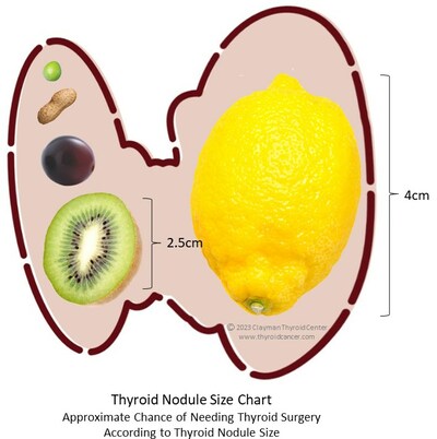 Renowned Surgeons Publish Thyroid Nodule Size Chart During Thyroid Disease Awareness Month