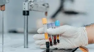 Pierre Fabre Pharmaceuticals Submits Type A Meeting Request to U.S. Food and Drug Administration (FDA) for Tabelecleucel Biologic License Application (BLA)