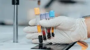 Novartis receives positive CHMP opinion for Cosentyx® in polymyalgia rheumatica (PMR)