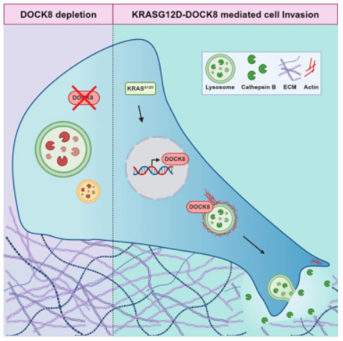 Cell Rep：科学家揭示胰腺癌扩散的新型分子机制