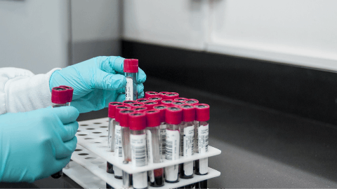 Regen BioPharma, Inc. to Seek Orphan Drug Designation for Lead Product