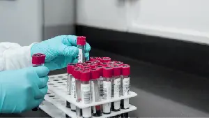Regen BioPharma, Inc. to Seek Orphan Drug Designation for Lead Product
