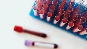 ImCheck’s Announces EMA Orphan Drug Designation for ICT01  as Treatment for Acute Myeloid Leukemia