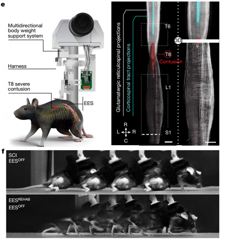 《自然》重磅：让瘫痪者再次行走，这项神奇技术只要5个月！
