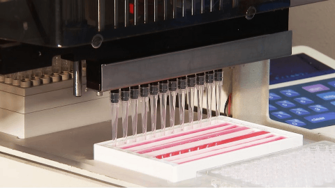 European Medicines Agency Recommends Marketing Approval of Gobivaz®, Alvotech’s Proposed Biosimilar to Simponi® (golimumab) with Advanz Pharma as Commercialization Partner