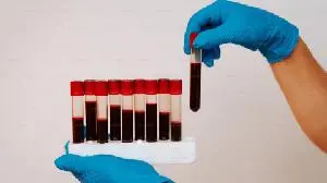 Tanabe Pharma America Announces Positive Topline Results for Dersimelagon in Erythropoietic Protoporphyria (EPP) and X-Linked Protoporphyria (XLP)