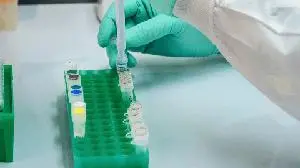 Capricor Therapeutics Announces Positive Data Demonstrating Long-Term Efficacy of Deramiocel for the Treatment of Duchenne Muscular Dystrophy