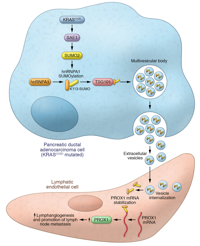 J Clin Invest: KRAS基因突变是胰腺癌细胞外小泡淋巴管生成的重要启动子