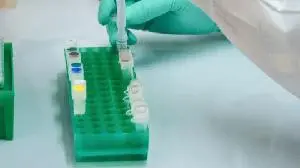 InflaRx Reports Positive Phase 2a Data for INF904 in Hidradenitis Suppurative (HS) and Chronic Spontaneous Urticaria (CSU)