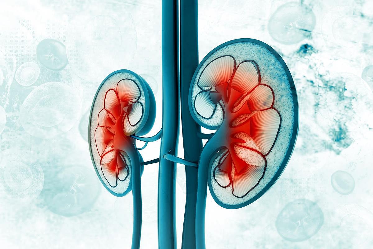 High Metabolic Syndrome Severity Linked to Development of CKD