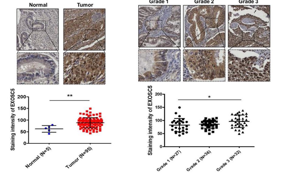 中国台湾阳明交通大学的研究者们为子宫内膜癌的诊断和治疗提供了潜在的途径