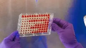 Vanda Pharmaceuticals Announces FDA Acceptance of Biologics License Application Filing for Imsidolimab for the Treatment of Generalized Pustular Psoriasis