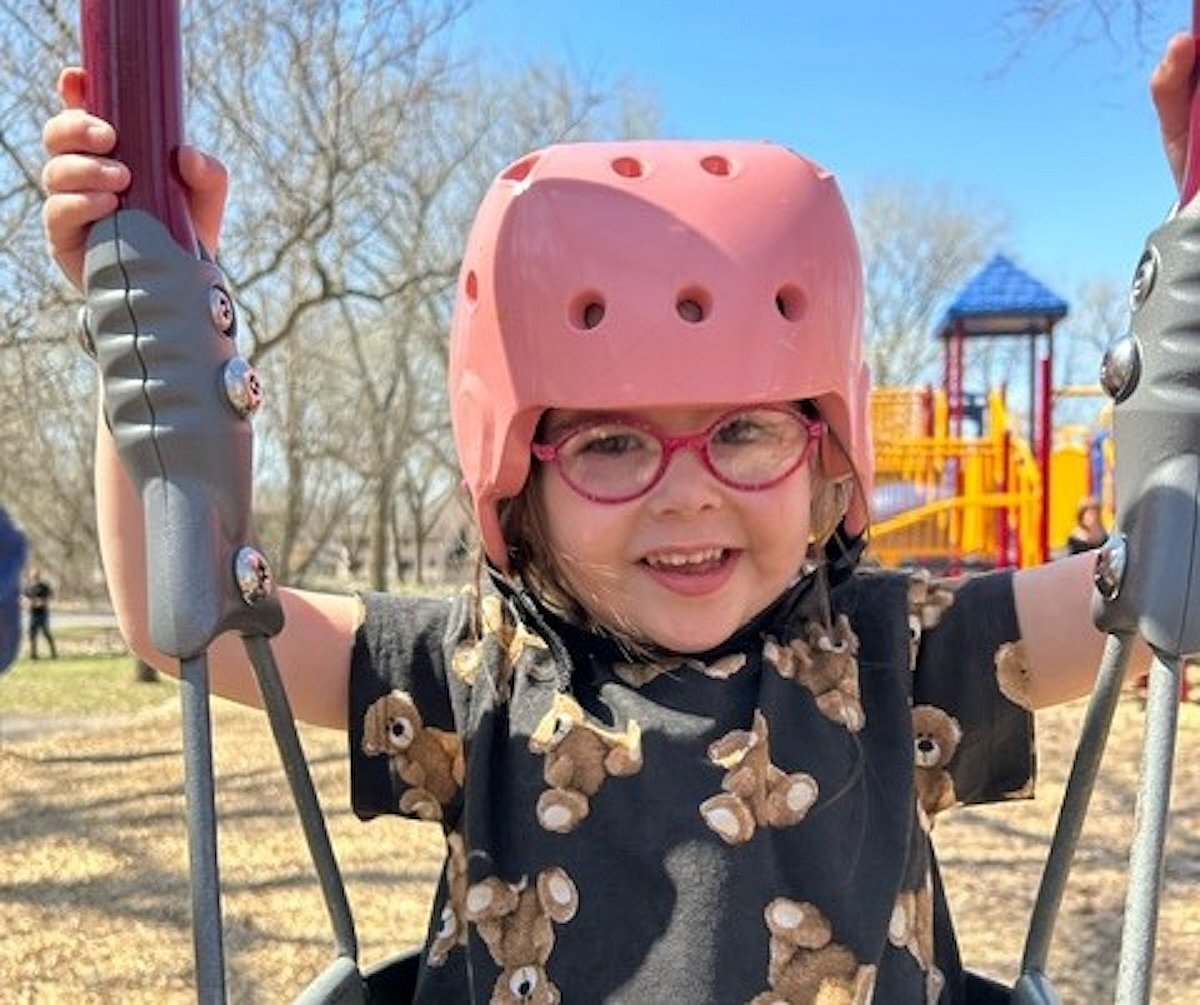 Keto Diet Stops A Young Girl's Epileptic Seizures