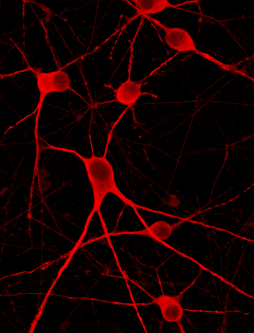 bit.bio further expands ioCells™️ range with early access launch of ioMotor Neurons™️ for research and drug discovery in diseases such as amyotrophic lateral sclerosis (ALS)
