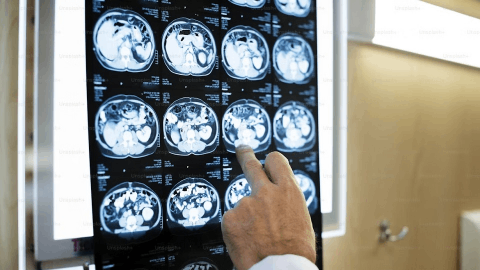 Vera Therapeutics Announces Positive ORIGIN Phase 3 Data for Atacicept in IgA Nephropathy Presented at ASN Kidney Week 2025 and Published in the New England Journal of Medicine