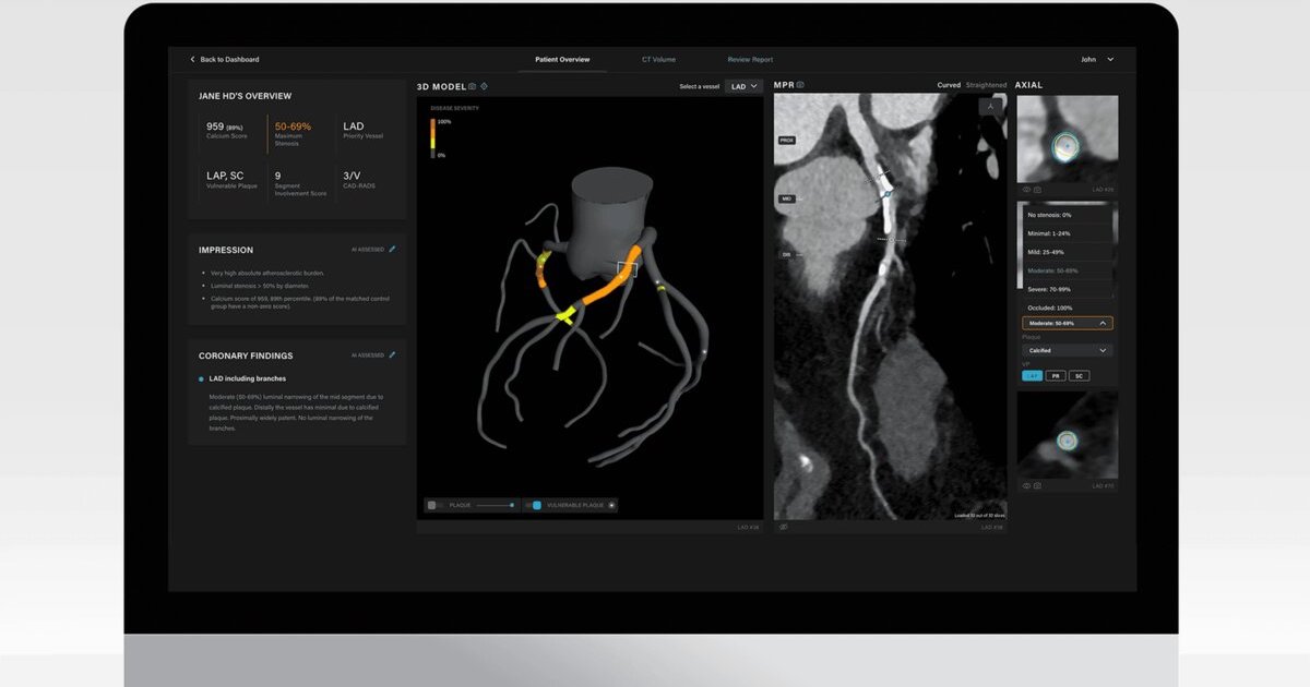 Roundup: Artrya bags more market approvals for AI software after US FDA setback and more briefs