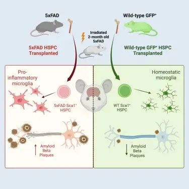 最新研究：干细胞疗法缓解阿尔茨海默病的症状