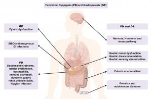 eGastroenterology Review Redefines Functional Dyspepsia, Gastroparesis Treatment