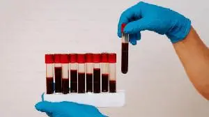 Ajax Therapeutics Presents Preclinical Data on Differentiated Efficacy Profile of AJ1-11095, a First-in-Class Type II JAK2 Inhibitor, at the American Society of Hematology Annual Meeting