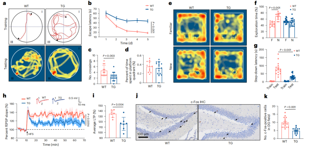 《自然·代谢》：南京鼓楼医院团队发现，硬骨蛋白异常升高会加速阿尔茨海默病发展！