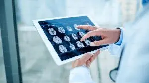 Avadel Pharmaceuticals Announces Completion of Enrollment in Phase 3 REVITALYZ™ Trial in Idiopathic Hypersomnia