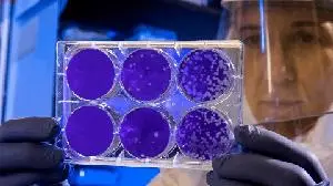 PridCor Therapeutics Reports Positive Long COVID Case Series with Combination Antiviral Regimen