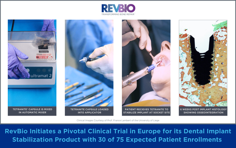 RevBio Initiates its Pivotal Clinical Trial in Europe for its Dental Implant Stabilization Product