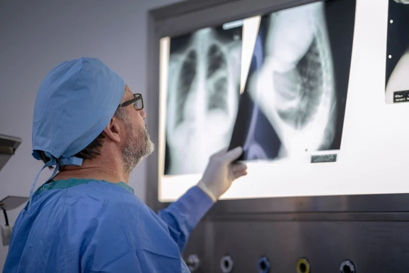 Deep learning AI could predict heart disease death from a chest X-ray 10 years out: study