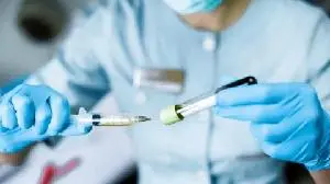 BioCryst Announces FDA Acceptance of NDA for ORLADEYO® (berotralstat) Oral Granules in Patients with Hereditary Angioedema Aged 2 to 11 Years