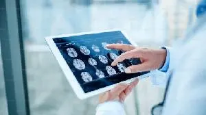 Cognition Therapeutics Completes Enrollment in Phase 2 Study of Zervimesine (CT1812) in Early Alzheimer’s Disease