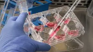 Context Therapeutics Announces CTIM-76 Receives FDA Fast Track Designation for the Treatment of Platinum-Resistant Ovarian Cancer