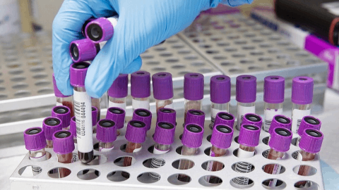 EXACT Therapeutics announces first patient dosed in Phase 2 trial in patients with locally advanced pancreatic cancer