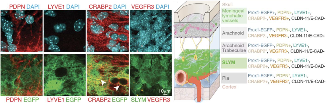 《科学》：改写教科书！科学家首次发现，人类大脑或存在第四层脑膜！