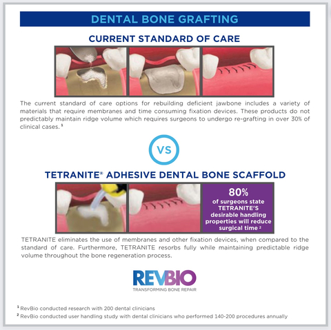 RevBio is Awarded a $2 Million Grant to Advance the Development of its Novel Dental Adhesive Bone Scaffold Product