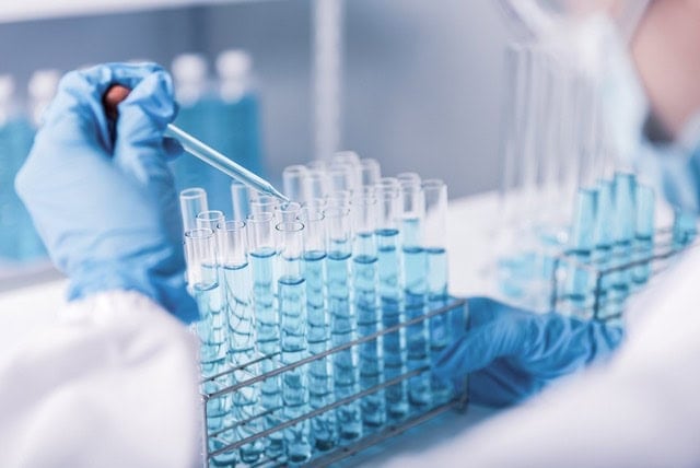 Cancer researchers investigate why smouldering myeloma progresses 