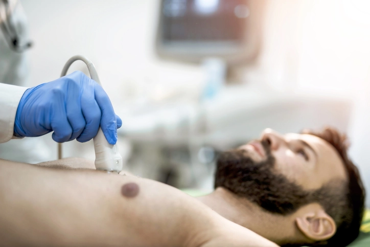 GE HealthCare Acquires Company that Democratizes Cardiac Ultrasound Images