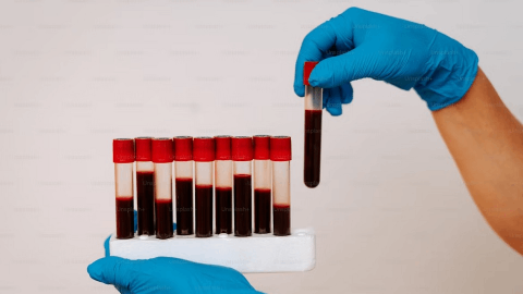 Vor Bio Announces Late-Breaking Poster Presentation of Phase 3 Primary Sjögren’s Disease Clinical Study at ACR Convergence 2025